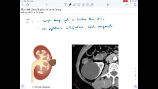 Bosniak classification of renal cysts [upl. by Llenyt]