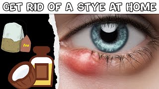 How To Get Rid Of A Stye At Home Natural Remedies For Stye Best Ways To Get Rid Of A Stye Easily [upl. by Nnylirret978]