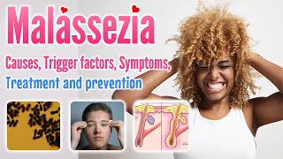 Malassezia causes conditions symptoms trigger factor treatment and prevention [upl. by Wheeler996]