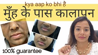 Seborrheic Dermatitis Scalp amp Face l रूसी का बेहतरीन उपाय [upl. by Adnalay676]