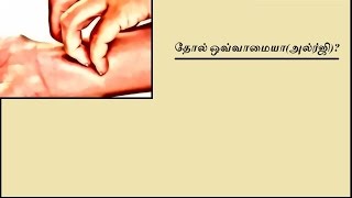 Tamil ayurveda maruthuvam  tholil erpadum arippu thadippu matrum sivantha nira pirachanai [upl. by Mastrianni]