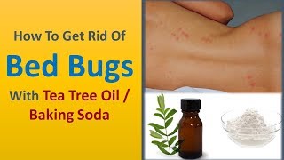 how to get rid of bed bugs with Tea Tree Oil  Baking Soda [upl. by Miguel]