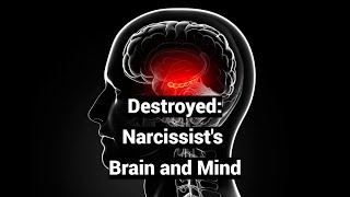 Destroyed Narcissists Brain and Mind Infant Amnesia Psychotic Grandiosity [upl. by Naivaj65]