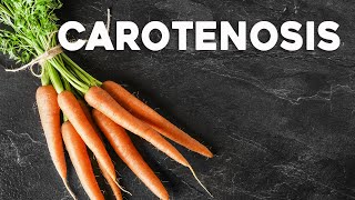 How Too Many Carrots Can Turn Your Skin Orange  Carotenosis  Corporis [upl. by Leksehcey]