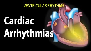 Cardiac Arrhythmias Animation [upl. by Adur680]