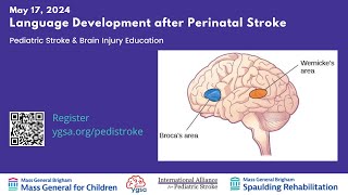 Language Development after Perinatal Stroke [upl. by Selinda]