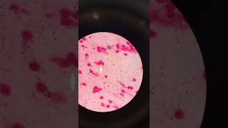 Lactose fermenters on MacConkey agar [upl. by Tocs]