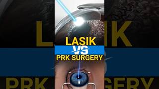 Lasik Vs PRK Surgery for Specs Removal [upl. by Aylad]