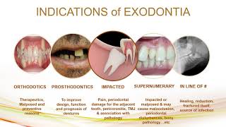 indication and contraindication of exodontia [upl. by Francie]