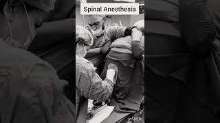 Spinal Anesthesia Procedure [upl. by Kara932]