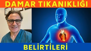 Damar tıkanıklığı belirtileri nelerdir Sağlık Videoları SERDAR AKGÜN [upl. by Stranger]