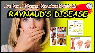 What is Raynaud Disease  Causes  What are the Treatments  Complications  English  2022 [upl. by Biegel41]