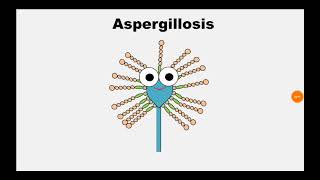 5 Aspergillosis [upl. by Mayap201]