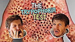 Trypophobia Test  The Phobia You Never Knew You Had [upl. by Eemiaj]