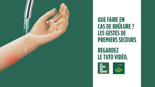 Que faire en cas de brûlure  Les gestes de premiers secours [upl. by Nibor]