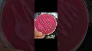 Macconkey agar microbiology macConkeyagar microbiology agar [upl. by Port]