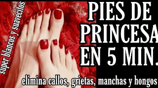 PIES DE PRINCESA en 5 Min ELIMINA callos grietas hongos blanquea e hidrata [upl. by Adiuqram]