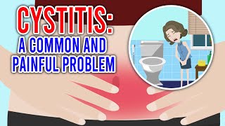 CYSTITIS Its Causes Symptoms and Treatment [upl. by Callan]