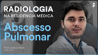 Abscesso Pulmonar  Radiologia na Residência Médica [upl. by Shaver841]