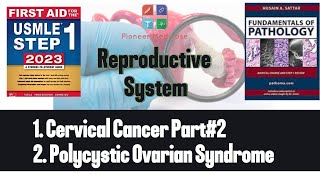 USMLE step 1Cervical carcinoma PCOS from First AidReproductive PathologyUrduHindi [upl. by Elbon392]