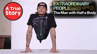 The Man With Half A Body The FULL Documentary  A True Story [upl. by Mann]