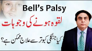 Bells Palsy  Laqwa ka Ilaj  Facial Paralysis Causes amp Treatment By Dr Khalid Jamil [upl. by Buffo]