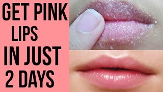 How to get pink lips Lighten dark lips naturally at home Get Rid Of Chapped Lips [upl. by Mitchel657]