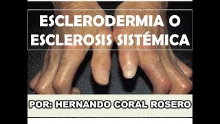 ESCLERODERMIA O ESCLEROSIS SISTÉMICA ENGROSAMIENTO Y ENDURECIMIENTO DE LA PIEL [upl. by Flore]