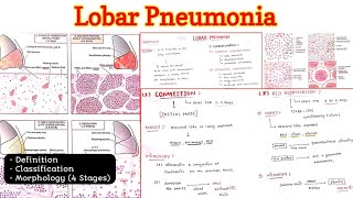 Lobar Pneumonia  Respiratory System  Pathology [upl. by Nosbig]