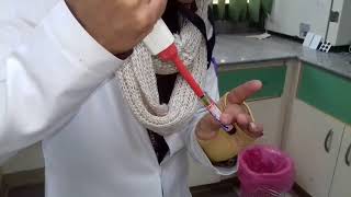 E10 How to treat a high blood Lipid sample  Lipemic [upl. by Gerianne]