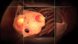 In Vitro Fertilization IVF documentary part 1 [upl. by Cicily]