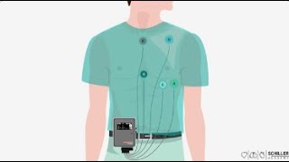 SCHILLER Holter Monitoring [upl. by Nnyladnarb621]