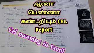 How to Gender prediction using CRL in tamilஆணா பெண்ணா என கண்டறியும் Report [upl. by Anawat209]