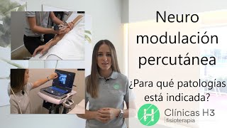 Neuromodulación percutánea ecoguiada 💹 ¿Para quién sirve 💹Clinicas H3 Madrid [upl. by Terej]