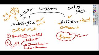 Bronchiectasis شرح كامل [upl. by Giefer]