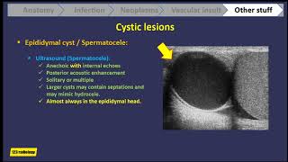 Scrotal ultrasound part 2 [upl. by Hoang]