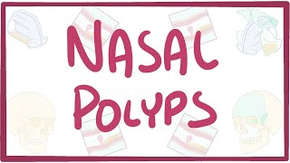 Nasal Polyps  causes symptoms diagnosis treatment pathology [upl. by Naillij]