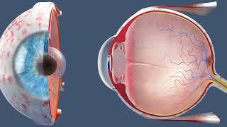 Cataract Surgery  Inside the OR [upl. by Constantina]