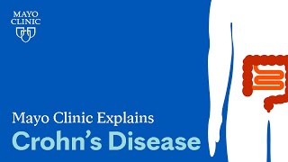 Mayo Clinic Explains Crohn’s Disease [upl. by Eeluj373]