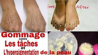 Comment se débarrasser des tâches sur le Corps et les pieds Gommage Lhyperpigmentation de la peau [upl. by Ynes]