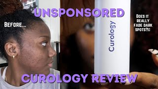 Curology Review NOT SPONSORED  Does it really work [upl. by Heim]