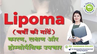 Understanding Lipoma Causes Symptoms and Treatment Options  Expert Insightsdrvandanagulati [upl. by Tips]