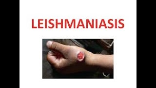 Novedades en diagnóstico y tratamiento de Leishmaniasis cutánea y visceral en niños [upl. by Nnaes]