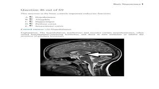 SCE MRCP Questions Update in Neurology From BoardVitals [upl. by Carson]