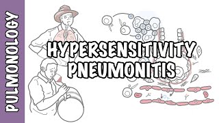 Hypersensitivity pneumonitis [upl. by Uund865]