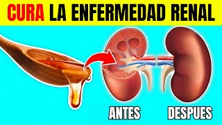 NUNCA MÁS un paciente renal volverá a perder un riñón Mira Esto [upl. by Hessler]