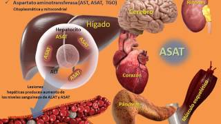 Ictericia de causas prehepáticas [upl. by Atalya]