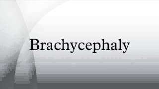 Brachycephaly [upl. by Joelle]