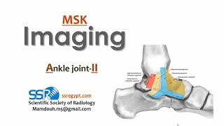 13 Ankle joint imaging II TEC Prof Mamdouh Mahfouz [upl. by Ebarta]