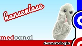 Hanseníase  DERMATOLOGIA [upl. by Freda]